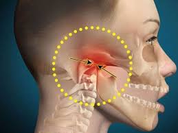 TMJ Treatment with Digital Tools and Night Guards 