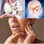 TMJ Treatment with Digital Tools and Night Guards